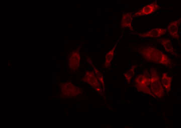 CA-VB / CA5B Antibody - Staining NIH-3T3 cells by IF/ICC. The samples were fixed with PFA and permeabilized in 0.1% Triton X-100, then blocked in 10% serum for 45 min at 25°C. The primary antibody was diluted at 1:200 and incubated with the sample for 1 hour at 37°C. An Alexa Fluor 594 conjugated goat anti-rabbit IgG (H+L) Ab, diluted at 1/600, was used as the secondary antibody.