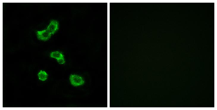 CA-VB / CA5B Antibody - Peptide - + Immunofluorescence analysis of MCF-7 cells, using CA5B antibody.