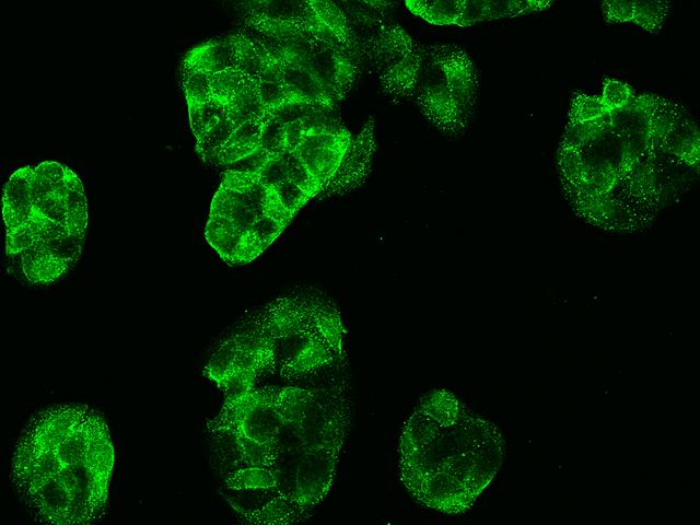 CA-VB / CA5B Antibody - Immunofluorescence staining of CA5B in MCF7 cells. Cells were fixed with 4% PFA, permeabilzed with 0.1% Triton X-100 in PBS, blocked with 10% serum, and incubated with rabbit anti-Human CA5B polyclonal antibody (dilution ratio 1:1000) at 4°C overnight. Then cells were stained with the Alexa Fluor 488-conjugated Goat Anti-rabbit IgG secondary antibody (green). Positive staining was localized to Cytoplasm.