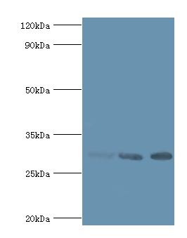 CA1 / Carbonic Anhydrase I Antibody - Western blot. All lanes: Carbonic anhydrase 1 antibody at 6 ug/ml. Lane 1: Jurkat whole cell lysate. Lane 2: K562 whole cell lysate. Lane 3: mouse spleen tissue <div>. secondary Goat polyclonal to rabbit at 1:10000 dilution. Predicted band size: 29 kDa. Observed band size: 29 kDa.