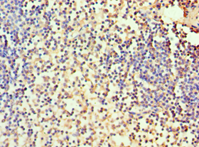 CA1 / Carbonic Anhydrase I Antibody - Immunohistochemistry of paraffin-embedded human spleen using antibody at 1:100 dilution.