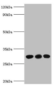 CA1 / Carbonic Anhydrase I Antibody - Western blot All lanes: CA1 antibody at 6µg/ml Lane 1: Jurkat whole cell lysate Lane 2: K562 whole cell lysate Lane 3: Mouse spleen tissue Secondary Goat polyclonal to rabbit IgG at 1/10000 dilution Predicted band size: 29 kDa Observed band size: 29 kDa