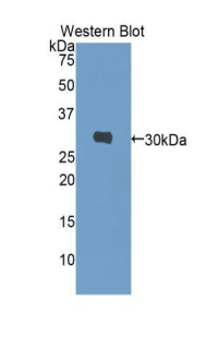 CA1 / Carbonic Anhydrase I Antibody - Western blot of recombinant CA1 / Carbonic Anhydrase I.  This image was taken for the unconjugated form of this product. Other forms have not been tested.