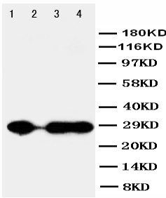 CA1 / Carbonic Anhydrase I Antibody - WB of CA1 / Carbonic Anhydrase I antibody. Lane 1: Rat Spleen Tissue Lysate. Lane 2: Rat Testis Tissue Lysate. Lane 3: Rat Kidney Tissue Lysate. Lane 4: Rat Lung Tissue Lysate.