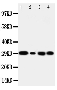 CA1 / Carbonic Anhydrase I Antibody - Anti-Carbonic Anhydrase I antibody, Western blotting Lane 1: Rat Spleen Tissue LysateLane 2: Rat Testis Tissue LysateLane 3: Rat Kidney Tissue LysateLane 4: Rat Lung Tissue Lysate