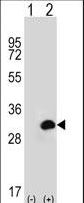 CA1 / Carbonic Anhydrase I Antibody - Western blot of CA1 (arrow) using rabbit polyclonal CA1 Antibody. 293 cell lysates (2 ug/lane) either nontransfected (Lane 1) or transiently transfected (Lane 2) with the CA1 gene.