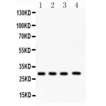 CA1 / Carbonic Anhydrase I Antibody - CA1 antibody Western blot. All lanes: Anti CA1 at 0.5 ug/ml. Lane 1: Rat Spleen Tissue Lysate at 50 ug. Lane 2: Rat Liver Tissue Lysate at 50 ug. Lane 3: Rat Kidney Tissue Lysate at 50 ug. Lane 4: Human Placenta Tissue Lysate at 50 ug. Predicted band size: 29 kD. Observed band size: 29 kD.
