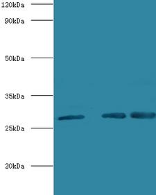 CA1 / Carbonic Anhydrase I Antibody - Western blot of Carbonic anhydrase 1 antibody at 2 ug/ml lane 1: K562 whole cell lysate lane 2: Jurkat whole cell lysate lane 3: mouse liver tissue Secondary Goat polyclonal to Rabbit lgG at 1:15000 dilution. Predicted band size: 28 KDa. Observed band size: 28 KDa.  This image was taken for the unconjugated form of this product. Other forms have not been tested.