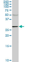 CA1 / Carbonic Anhydrase I Antibody - CA1 monoclonal antibody (M02), clone M2. Western Blot analysis of CA1 expression in human lung cancer.