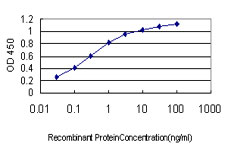 CA1 / Carbonic Anhydrase I Antibody - Detection limit for recombinant GST tagged CA1 is approximately 0.03 ng/ml as a capture antibody.