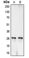 CA1 / Carbonic Anhydrase I Antibody - Western blot analysis of Carbonic Anhydrase 1 expression in TF1 (A); K562 (B) whole cell lysates.