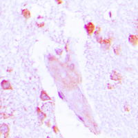 CA1 / Carbonic Anhydrase I Antibody - Immunohistochemical analysis of Carbonic Anhydrase 1 staining in human brain formalin fixed paraffin embedded tissue section. The section was pre-treated using heat mediated antigen retrieval with sodium citrate buffer (pH 6.0). The section was then incubated with the antibody at room temperature and detected using an HRP conjugated compact polymer system. DAB was used as the chromogen. The section was then counterstained with hematoxylin and mounted with DPX.