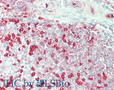 CA1 / Carbonic Anhydrase I Antibody - Immunohistochemistry of Goat anti-Carbonic Anhydrase I antibody. Tissue: spleen. Fixation: formalin fixed paraffin embedded. Antigen retrieval: not required. Primary antibody: anti-Carbonic Anhydrase I antibody at 5 µg/mL for 1 h at RT. Secondary antibody: Peroxidase goat secondary antibody at 1:10,000 for 45 min at RT. Staining: Carbonic Anhydrase 1 as precipitated red signal with hematoxylin purple nuclear counterstain.
