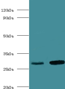 CA1 / Carbonic Anhydrase I Antibody - Western blot of Carbonic anhydrase 1 antibody at 2 ug/ml lane 1: mouse kidney tissue lane 2: mouse lung tissue secondary Goat polyclonal to rabbit at 1:10000 dilution predicted band size: 28 KDa observed band size: 28 KDa.