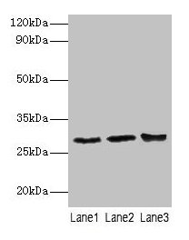 CA1 / Carbonic Anhydrase I Antibody - Western blot All lanes: Carbonic anhydrase 1 antibody at 2µg/ml Lane 1: Mouse kidney tissue Lane 2: Mouse lung tissue Secondary Goat polyclonal to rabbit IgG at 1/10000 dilution Predicted band size: 28 kDa Observed band size: 28 kDa