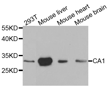 CA1 / Carbonic Anhydrase I Antibody - Western blot analysis of extracts of various cell lines, using CA1 antibody at 1:1000 dilution. The secondary antibody used was an HRP Goat Anti-Rabbit IgG (H+L) at 1:10000 dilution. Lysates were loaded 25ug per lane and 3% nonfat dry milk in TBST was used for blocking.