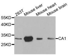 CA1 / Carbonic Anhydrase I Antibody - Western blot analysis of extracts of various cell lines, using CA1 antibody at 1:1000 dilution. The secondary antibody used was an HRP Goat Anti-Rabbit IgG (H+L) at 1:10000 dilution. Lysates were loaded 25ug per lane and 3% nonfat dry milk in TBST was used for blocking.
