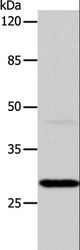 CA1 / Carbonic Anhydrase I Antibody - Western blot analysis of Mouse liver tissue, using CA1 Polyclonal Antibody at dilution of 1:450.