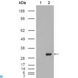 CA1 / Carbonic Anhydrase I Antibody - Western Blot (WB) analysis using CA I Monoclonal Antibody against HEK293T cells transfected with the pCMV6-ENTRY control (1) and pCMV6-ENTRY CA1 cDNA (2).