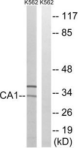 CA1 / Carbonic Anhydrase I Antibody - Western blot analysis of extracts from K562 cells, using CA1 antibody.