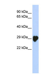 CA1 / Carbonic Anhydrase I Antibody - CA1 / Carbonic Anhydrase I antibody Western blot of Placenta lysate.  This image was taken for the unconjugated form of this product. Other forms have not been tested.