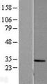 CA1 / Carbonic Anhydrase I Protein - Western validation with an anti-DDK antibody * L: Control HEK293 lysate R: Over-expression lysate