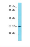 CA10 / Carbonic Andhydrase X Antibody - Western blot of Human Esophagus Tumor. CA10 antibody dilution 1.0 ug/ml.  This image was taken for the unconjugated form of this product. Other forms have not been tested.