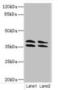 CA10 / Carbonic Andhydrase X Antibody - Western blot All Lanes: CA10 antibody at 4ug/ml Lane 1: HL60 whole cell lysate Lane 2: Mouse brain tissue Secondary Goat polyclonal to Rabbit IgG at 1/10000 dilution Predicted band size: 38,30 kDa Observed band size: 38 kDa