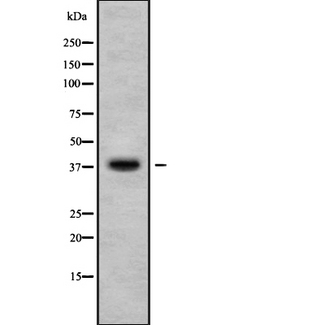 CA10 / Carbonic Andhydrase X Antibody - Western blot analysis of CA10 using HuvEc whole cells lysates