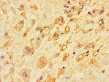 CA11 / Carbonic Anhydrase XI Antibody - Immunohistochemistry of paraffin-embedded human placenta tissue using CA11 Antibody at dilution of 1:100