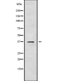 CA11 / Carbonic Anhydrase XI Antibody - Western blot analysis of CA11 using COS7 whole cells lysates