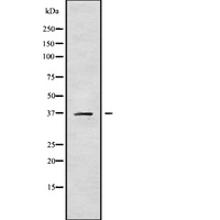 CA11 / Carbonic Anhydrase XI Antibody - Western blot analysis of CA11 using COS7 whole cells lysates