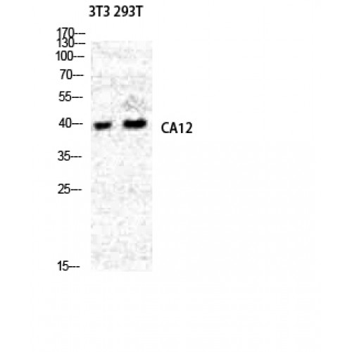 CA12 / Carbonic Anhydrase XII Antibody - Western blot of CA XII antibody