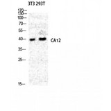 CA12 / Carbonic Anhydrase XII Antibody - Western blot of CA XII antibody