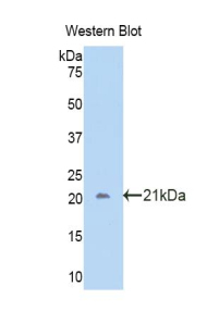 CA12 / Carbonic Anhydrase XII Antibody - Western blot of recombinant CA12 / Carbonic Andhydrase XII.  This image was taken for the unconjugated form of this product. Other forms have not been tested.