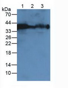 CA12 / Carbonic Anhydrase XII Antibody - Western Blot; Lane1: Human Blood Cells; Lane2: Rat Blood Cells; Lane3: Mouse Blood Cells.