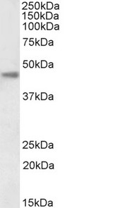 CA12 / Carbonic Anhydrase XII Antibody - Biotinylated EB12320 (0.1µg/ml) staining of Human Kidney lysate (35µg protein in RIPA buffer), exactly mirroring its parental non-biotinylated product. Primary incubation was 1 hour. Detected by chemiluminescence, using streptavidin-HRP and using NAP bloc
