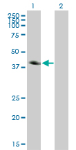 CA12 / Carbonic Anhydrase XII Antibody - Western Blot analysis of CA12 expression in transfected 293T cell line by CA12 monoclonal antibody (M01), clone 1D4.Lane 1: CA12 transfected lysate(39.5 KDa).Lane 2: Non-transfected lysate.