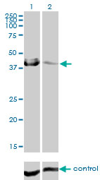 CA12 / Carbonic Anhydrase XII Antibody - Western blot analysis of CA12 over-expressed 293 cell line, cotransfected with CA12 Validated Chimera RNAi (Lane 2) or non-transfected control (Lane 1). Blot probed with CA12 monoclonal antibody (M01), clone 1D4 . GAPDH ( 36.1 kDa ) used as specificity and loading control.