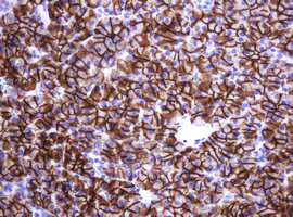 CA12 / Carbonic Anhydrase XII Antibody - IHC of paraffin-embedded Human pancreas tissue using anti-CA12 mouse monoclonal antibody.