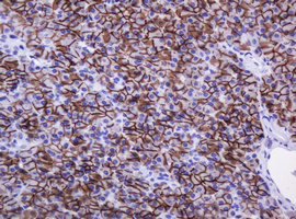 CA12 / Carbonic Anhydrase XII Antibody - IHC of paraffin-embedded Human pancreas tissue using anti-CA12 mouse monoclonal antibody.