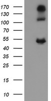 CA12 / Carbonic Anhydrase XII Antibody - HEK293T cells were transfected with the pCMV6-ENTRY control (Left lane) or pCMV6-ENTRY CA12 (Right lane) cDNA for 48 hrs and lysed. Equivalent amounts of cell lysates (5 ug per lane) were separated by SDS-PAGE and immunoblotted with anti-CA12.