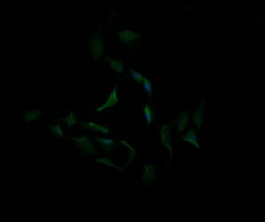 CA12 / Carbonic Anhydrase XII Antibody - Immunofluorescent staining of HeLa cells using anti-CA12 mouse monoclonal antibody.