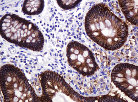 CA12 / Carbonic Anhydrase XII Antibody - IHC of paraffin-embedded Human colon tissue using anti-CA12 mouse monoclonal antibody. (Heat-induced epitope retrieval by 10mM citric buffer, pH6.0, 120°C for 3min).