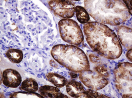 CA12 / Carbonic Anhydrase XII Antibody - IHC of paraffin-embedded Human Kidney tissue using anti-CA12 mouse monoclonal antibody. (Heat-induced epitope retrieval by 10mM citric buffer, pH6.0, 120°C for 3min).