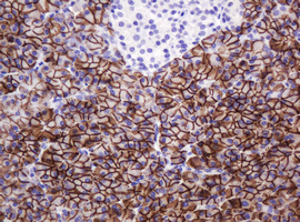 CA12 / Carbonic Anhydrase XII Antibody - IHC of paraffin-embedded Human pancreas tissue using anti-CA12 mouse monoclonal antibody. (Heat-induced epitope retrieval by 10mM citric buffer, pH6.0, 120°C for 3min).