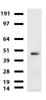 CA12 / Carbonic Anhydrase XII Antibody - Western blot of cell lysates. (35ug) from A549. Diluation: 1:500