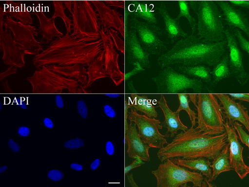 CA12 / Carbonic Anhydrase XII Antibody - Immunofluorescent staining of HeLa cells using anti-CA12 mouse monoclonal antibody  green, 1:50). Actin filaments were labeled with Alexa Fluor® 594 Phalloidin. (red), and nuclear with DAPI. (blue). Scale bar, 20µm.