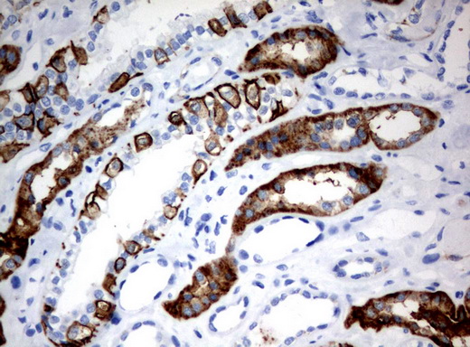 CA12 / Carbonic Anhydrase XII Antibody - Immunohistochemical staining of paraffin-embedded Human Kidney tissue using anti-CA12 mouse monoclonal antibody.  heat-induced epitope retrieval by 10mM citric buffer, pH6.0, 120C for 3min)