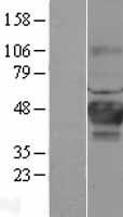 CA12 / Carbonic Anhydrase XII Protein - Western validation with an anti-DDK antibody * L: Control HEK293 lysate R: Over-expression lysate